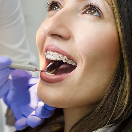 A woman with traditional braces