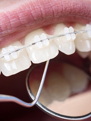 close up dental exam interdisciplinary orthodontics