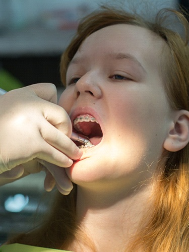 dental procedure with braces interdisciplinary orthodontics