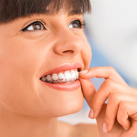 Woman placing Invisalign tray