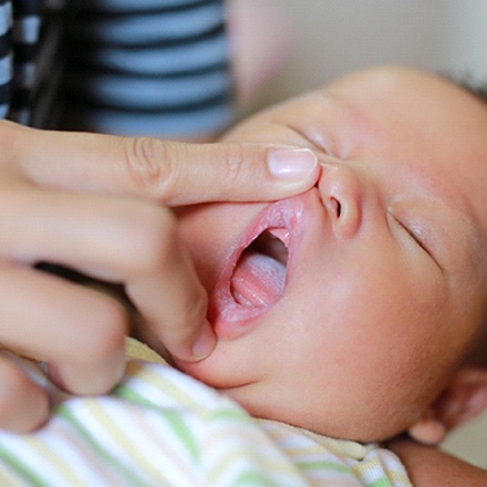 examining an infant’s mouth for a lip tie