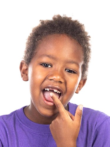 boy showing teeth