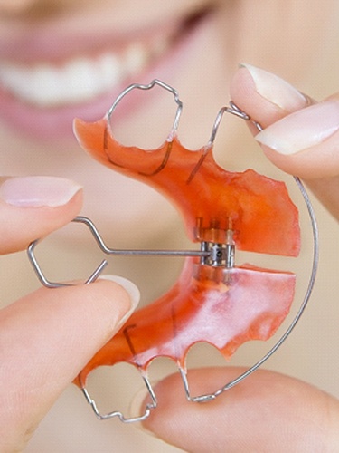 palatal expander