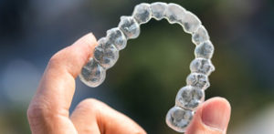 invisalign braces