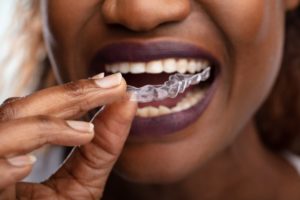 a person putting clear aligners in their mouth